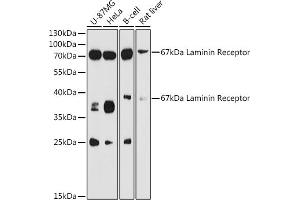 Western blot analysis of extracts of various cell lines, using 67 kDa Laminin Receptor antibody (ABIN6128199, ABIN6147247, ABIN6147248 and ABIN6224857) at 1:3000 dilution. (RPSA/Laminin Receptor anticorps  (AA 1-295))
