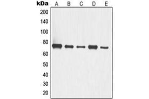 Western blot analysis of p63 expression in A549 (A), HCT116 (B), COLO205 (C), LOVO (D), HT29 (E) whole cell lysates. (TCP1 alpha/CCTA anticorps  (C-Term))