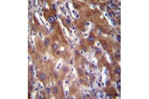 Immunohistochemistry analysis in formalin fixed and paraffin embedded human liver tissue reacted with GNE / GLCNE Antibody (N-term) followed by peroxidase conjugation of the secondary antibody and DAB staining. (GNE anticorps  (N-Term))