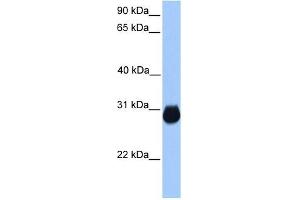 IGFBP7 antibody used at 1 ug/ml to detect target protein. (IGFBP7 anticorps  (C-Term))
