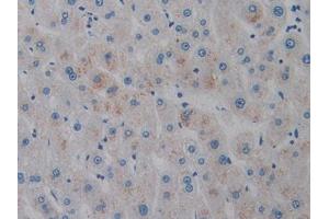 Used in DAB staining on fromalin fixed paraffin- embedded liver tissue