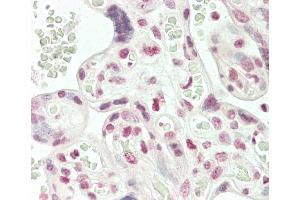 anti-rho GTPase Activating Protein 17 (ARHGAP17) (AA 41-70), (N-Term) antibody