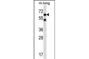 Mouse Nlk Antibody (C-term) (ABIN657850 and ABIN2846811) western blot analysis in mouse lung tissue lysates (35 μg/lane). (Nemo-Like Kinase anticorps  (C-Term))