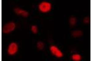 anti-Forkhead Box E3 (FOXE3) (Internal Region) antibody