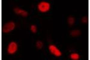 ABIN6274340 staining Hela cells by IF/ICC. (FOXE3 anticorps  (Internal Region))