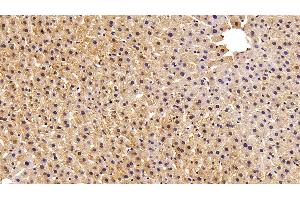 Detection of FABP1 in Rat Liver Tissue using Polyclonal Antibody to Fatty Acid Binding Protein 1 (FABP1) (FABP1 anticorps  (AA 2-127))