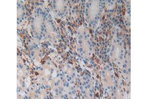 IHC-P analysis of Kidney tissue, with DAB staining. (MGA anticorps  (AA 2450-2733))