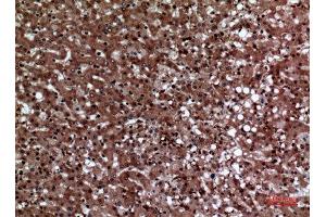 Immunohistochemistry (IHC) analysis of paraffin-embedded Human Liver, antibody was diluted at 1:100.