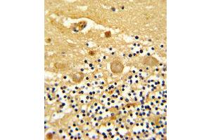 anti-Leucine Rich Repeat Containing 32 (LRRC32) (AA 234-260) antibody