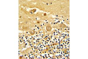 Formalin-fixed and paraffin-embedded human cerebellum reacted with GARP Antibody (Center), which was peroxidase-conjugated to the secondary antibody, followed by DAB staining.