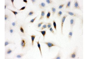 Anti- WASP Picoband antibody, ICC ICC: A549 Cell