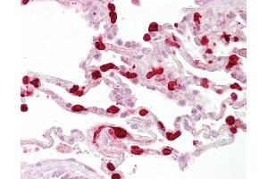 Anti-GSTT1 antibody IHC of human lung.