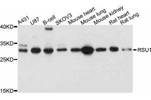 Western blot analysis of extracts of various cell lines, using RSU1 antibody (ABIN4905071) at 1:1000 dilution. (RSU1 anticorps)