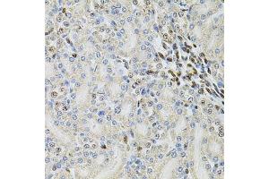 Immunohistochemistry of paraffin-embedded rat kidney using PSMC3 Antibody (ABIN3022704, ABIN3022705, ABIN3022706 and ABIN6219146) at dilution of 1:100 (40x lens). (PSMC3 anticorps  (AA 1-180))
