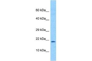 Host:  Rabbit  Target Name:  TCF21  Sample Tissue:  Human Ovary Tumor  Antibody Dilution:  1ug/ml