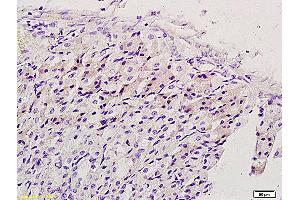 Immunohistochemistry (IHC) image for anti-EGFR vIII (EGFRv3) (AA 1-50) antibody (ABIN742035) (EGFRviii anticorps  (AA 1-50))