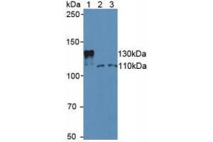 Western blot analysis of (1) Mouse Serum, (2) Human Jurkat Cells and (3) Human HeLa cells. (SIRT1 anticorps  (AA 236-490))