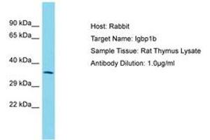 Image no. 1 for anti-Immunoglobulin (CD79A) Binding Protein 1b (IGBP1B) (AA 151-200) antibody (ABIN6750466) (IGBP1B anticorps  (AA 151-200))