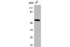 Western Blot analysis of 293 cells using CA IX Polyclonal Antibody (CA9 anticorps  (Internal Region))