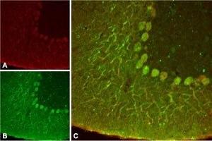 Expression of KCNK4 in rat cerebellumImmunohistochemical staining of rat cerebellum using Anti-KCNK4 (TRAAK) Antibody (ABIN7043454, ABIN7045004 and ABIN7045005 ). (Potassium Channel, Subfamily K, Member 4 (KCNK4) Peptide)