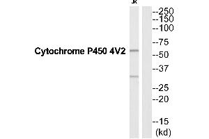 Western blot analysis of extracts from Jurkat cells, using CYP4V2 antibody. (CYP4V2 anticorps  (Internal Region))