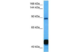 Host:  Mouse  Target Name:  NFATC2  Sample Tissue:  Mouse Kidney  Antibody Dilution:  1ug/ml (NFAT1 anticorps  (C-Term))
