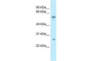 WB Suggested Anti-TTC39B Antibody Titration: 1.