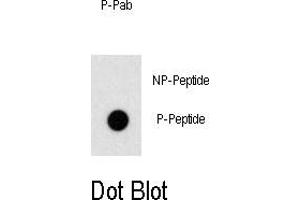 Image no. 1 for anti-Odd-Skipped Related 1 (OSR1) (pThr310) antibody (ABIN358502) (OSR1 anticorps  (pThr310))