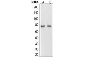 Western blot analysis of Netrin 1 expression in rat brain (A), PC12 (B) whole cell lysates. (Netrin 1 anticorps  (C-Term))
