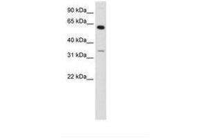 Image no. 1 for anti-Zinc Finger Protein 609 (ZNF609) (AA 71-120) antibody (ABIN202985)