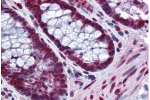 Human Colon: Formalin-Fixed, Paraffin-Embedded (FFPE)