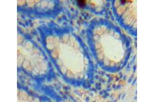 Used in DAB staining on fromalin fixed paraffin-embedded rectum tissue (NFKBIE anticorps  (AA 115-350))