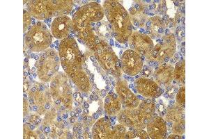 Immunohistochemistry of paraffin-embedded Rat kidney using PRKAB1 Polyclonal Antibody at dilution of 1:100 (40x lens). (PRKAB1 anticorps)