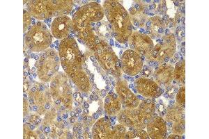 Immunohistochemistry of paraffin-embedded Rat kidney using PRKAB1 Polyclonal Antibody at dilution of 1:100 (40x lens).