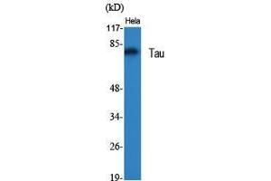 Western Blot (WB) analysis of specific cells using Tau Polyclonal Antibody.