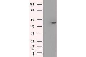 Image no. 13 for anti-Protein Phosphatase 5, Catalytic Subunit (PPP5C) antibody (ABIN1500390)
