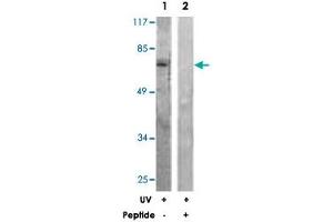 Western blot analysis of extracts from HeLa cells, treated with UV (5 mins), using RAF1 polyclonal antibody . (RAF1 anticorps)