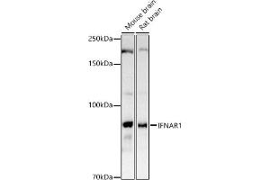Western blot analysis of extracts of various cell lines, using IFN antibody (ABIN3015552, ABIN3015553, ABIN1680393 and ABIN6218813) at 1:1000 dilution.