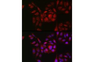 Immunofluorescence analysis of U2OS cells using RB Rabbit pAb (ABIN7269795) at dilution of 1:150 (40x lens). (RAB11B anticorps  (AA 130-215))