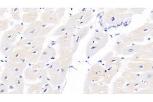 Detection of TNNT2 in Porcine Cardiac Muscle Tissue using Monoclonal Antibody to Troponin T Type 2, Cardiac (TNNT2) (Cardiac Troponin T2 anticorps  (AA 1-295))