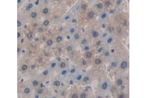 Used in DAB staining on fromalin fixed paraffin- embedded Kidney tissue (KNG1 anticorps  (AA 367-430))