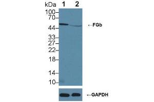 Western blot analysis of (1) Wild-type HeLa cell lysate, and (2) FGb knockout HeLa cell lysate, using Rabbit Anti-Human FGb Antibody (2 µg/ml) and HRP-conjugated Goat Anti-Mouse antibody (abx400001, 0.