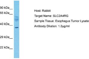 Host: Rabbit Target Name: SLC2A4RG Sample Type: Esophagus Tumor lysates Antibody Dilution: 1.