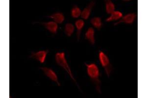 ABIN6267226 staining COS7 by IF/ICC.