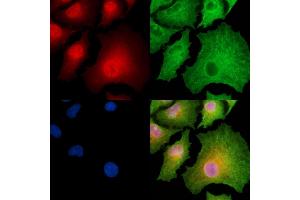 ABIN6262437 and ABIN6278874 staining  cells by IF/ICC.