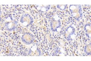 Detection of GSTA4 in Human Small intestine Tissue using Polyclonal Antibody to Glutathione S Transferase A4 (GSTA4)