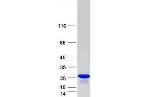 Validation with Western Blot