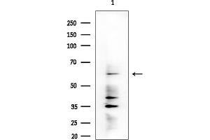 anti-Dystrophia Myotonica-Protein Kinase (DMPK) (N-Term) antibody