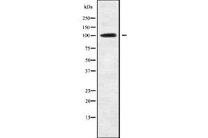 Western blot analysis of ETAA1 using RAW264. (ETAA1 anticorps  (Internal Region))