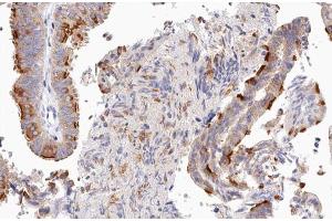 ABIN6266898 at 1/100 staining human Fallopian tube tissue sections by IHC-P. (UBXN11 anticorps  (Internal Region))